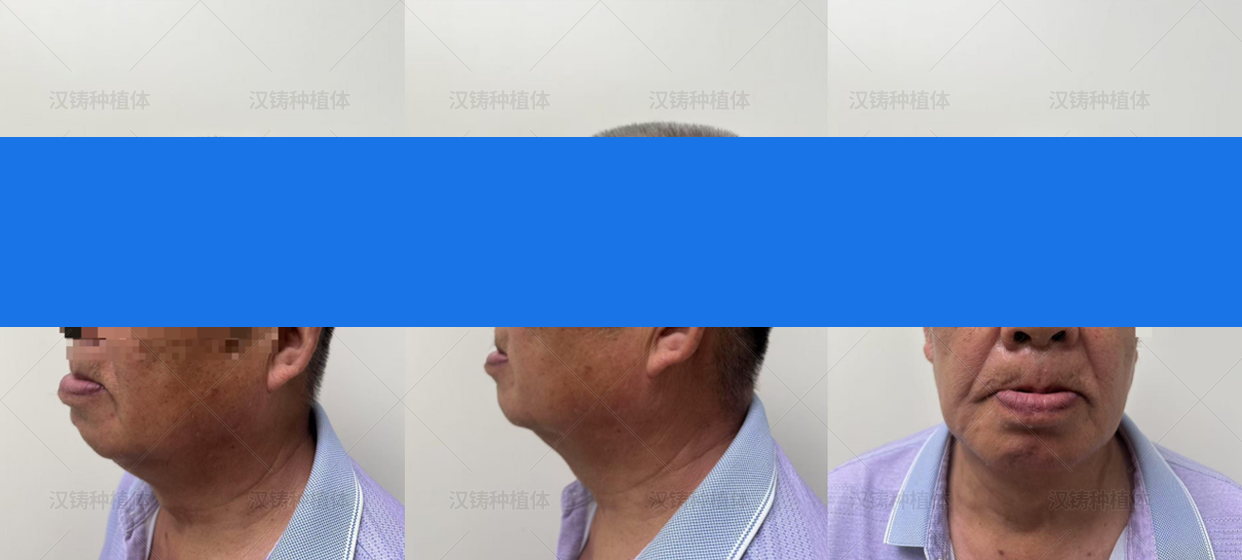 1778492788139788.png 1.png