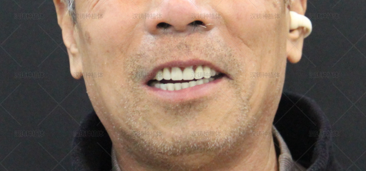 1778494997138975.png 3.png