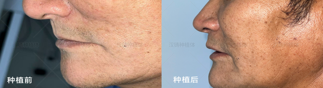 1778493304723751.png 5.png